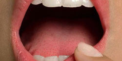 Patologia del cavo orale