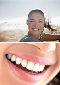 estetica denti implantologia